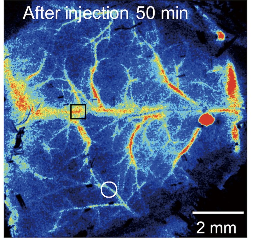 Microplastics Block Blood Flow in Mice Brains, Study Shows