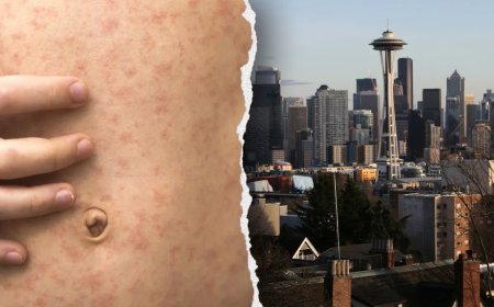 Officials in West Coast state sound alarm after traveler diagnosed with highly contagious viral disease
