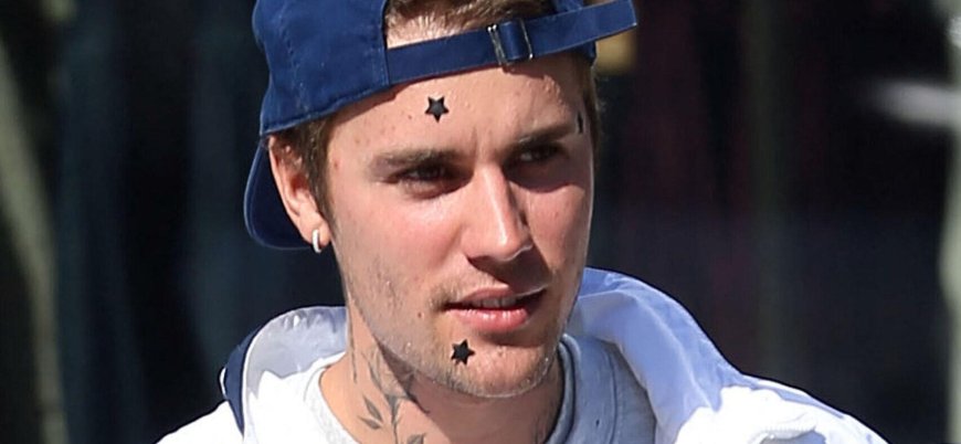 Justin Bieber's Latest Nipple Post Has Fans Begging Him To 'Go To Therapy'
